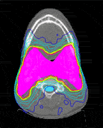 Radiation Oncology Photo